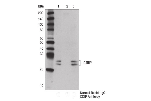 Immunoprecipitation Image 1: CDIP Antibody