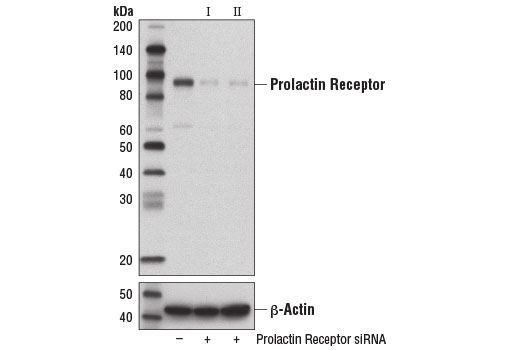  Image 1: SignalSilence® Prolactin Receptor siRNA II