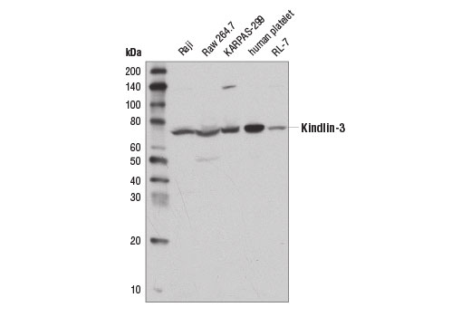 Western Blotting Image 1: Kindlin-3 Antibody