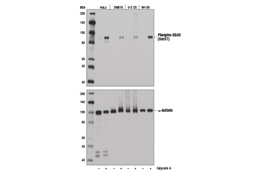Western Blotting Image 2: Phospho-SSH3 (Ser37) Antibody