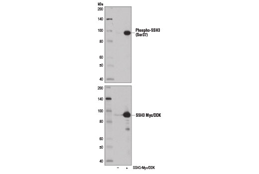 Western Blotting Image 3: Phospho-SSH3 (Ser37) Antibody