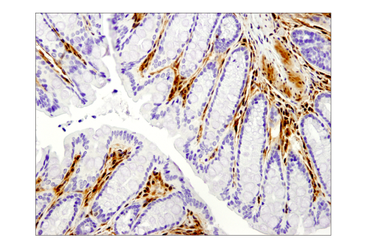 Immunohistochemistry Image 2: Galectin-1/LGALS1 (D608T) Rabbit mAb (IHC Formulated)
