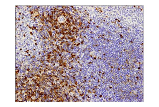 Immunohistochemistry Image 3: Galectin-1/LGALS1 (D608T) Rabbit mAb (IHC Formulated)