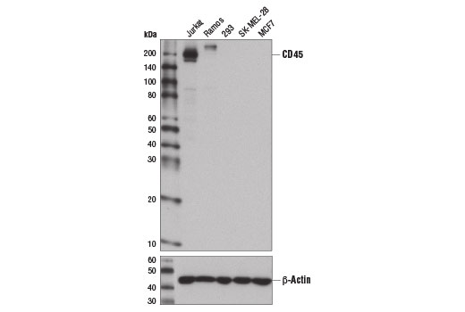 Western Blotting Image 1: CD45 (Intracellular Domain) (D9M8I) XP® Rabbit mAb