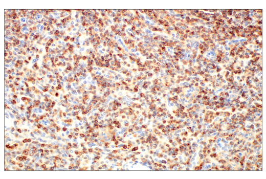 Immunohistochemistry Image 3: CD45 (Intracellular Domain) (D9M8I) XP® Rabbit mAb