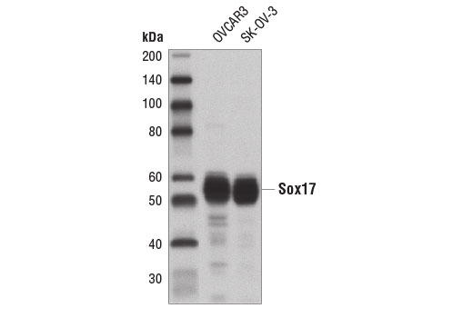 Western Blotting Image 1: Sox17 Antibody
