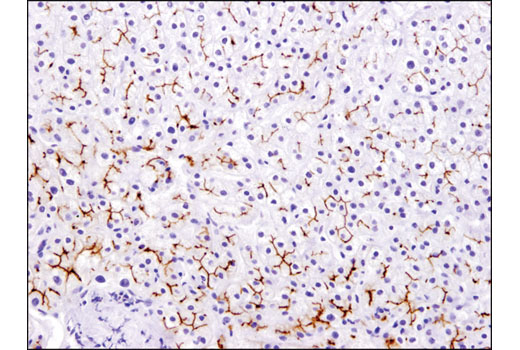 Immunohistochemistry Image 2: MDR1/ABCB1 (E1Y7S) Rabbit mAb