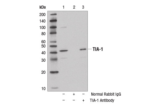 Immunoprecipitation Image 1: TIA-1 Antibody