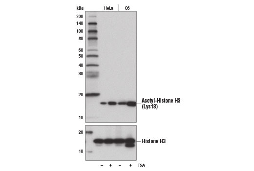 Western Blotting Image 1: Acetyl-Histone H3 (Lys18) (D8Z5H) Rabbit mAb