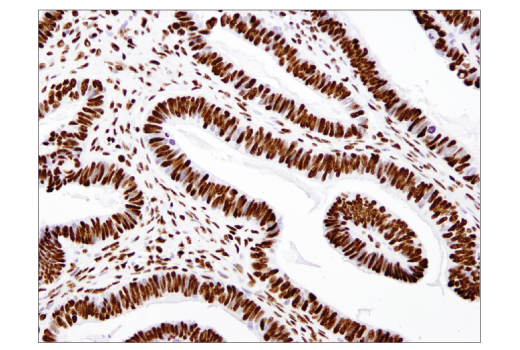 Immunohistochemistry Image 1: Acetyl-Histone H3 (Lys18) (D8Z5H) Rabbit mAb