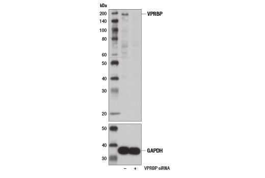  Image 1: SignalSilence® VPRBP siRNA I