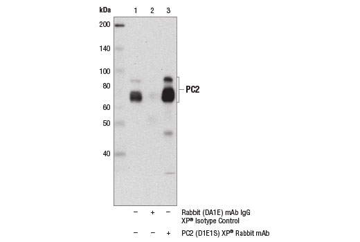 Immunoprecipitation Image 1: PC2 (D1E1S) XP® Rabbit mAb