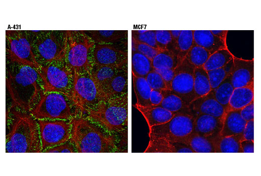 Immunofluorescence Image 1: P-Cadherin (12H6) Mouse mAb