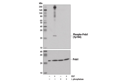  Image 1: Redox Homeostasis and Signaling Antibody Sampler Kit