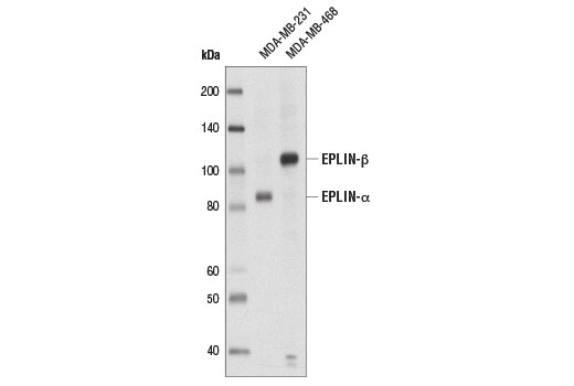 Western Blotting Image 1: EPLIN Antibody