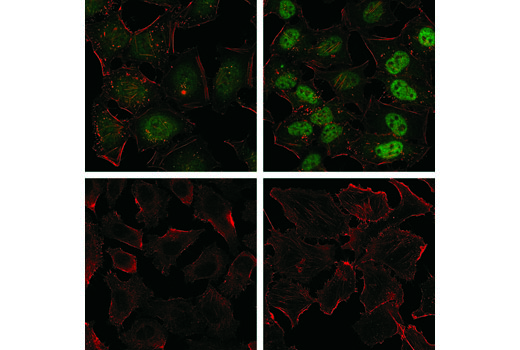 Immunofluorescence Image 1: Stat3 (D3Z2G) Rabbit mAb (Alexa Fluor® 488 Conjugate)