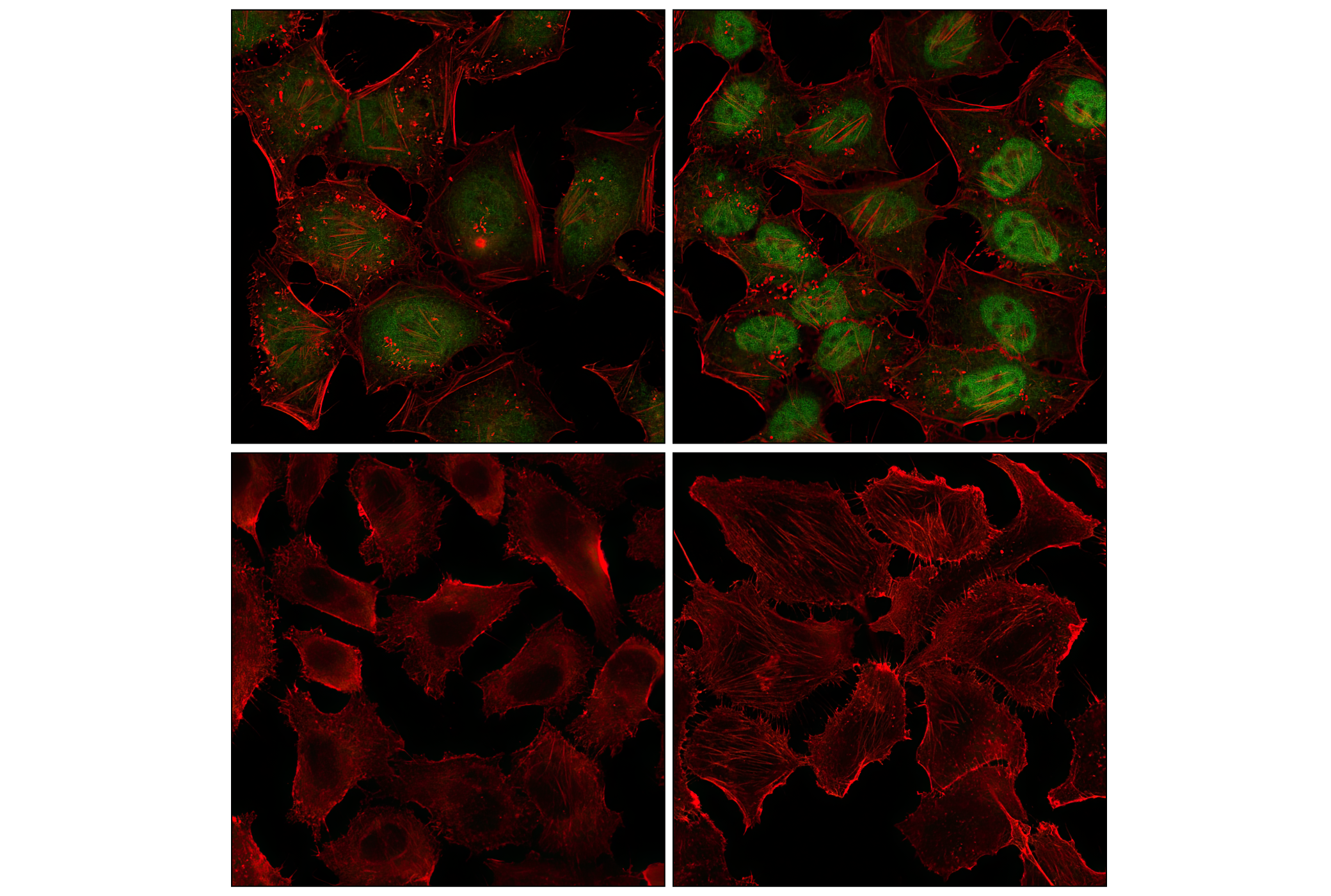 Immunofluorescence Image 1: Stat3 (D3Z2G) Rabbit mAb (Alexa Fluor® 488 Conjugate)