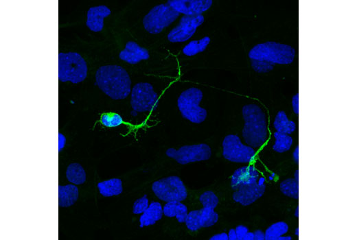 Immunofluorescence Image 2: Phospho-Doublecortin (Ser334) (D11B10) Rabbit mAb