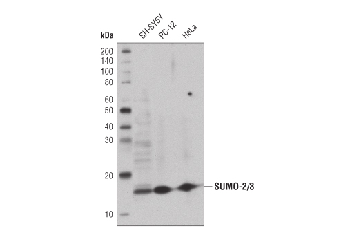 Western Blotting Image 1: SUMO-2/3 (18H8) Rabbit mAb (HRP Conjugate)