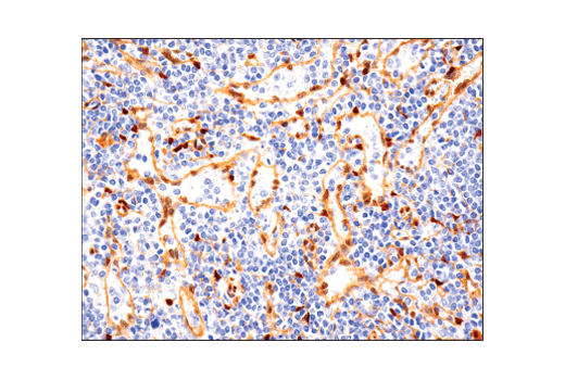  Image 34: Small Cell Lung Cancer Biomarker Antibody Sampler Kit