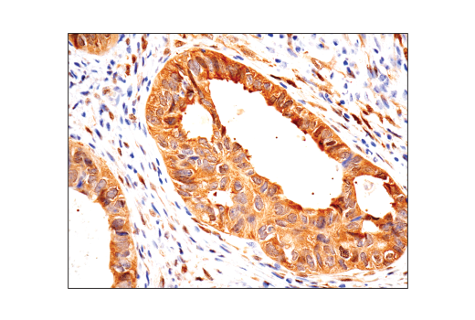  Image 38: Small Cell Lung Cancer Biomarker Antibody Sampler Kit