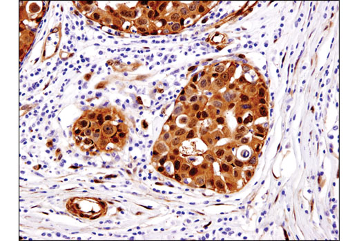  Image 46: Small Cell Lung Cancer Biomarker Antibody Sampler Kit