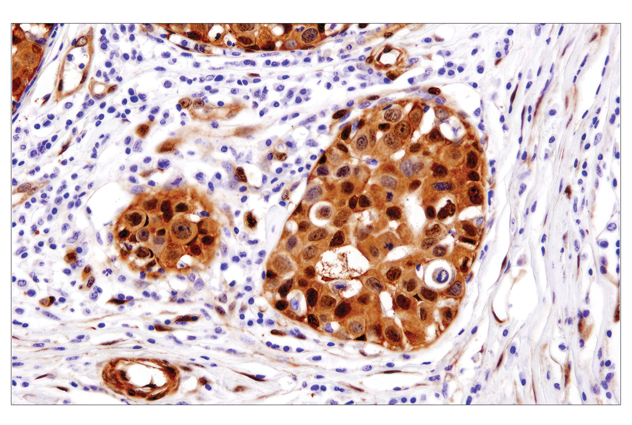  Image 52: Small Cell Lung Cancer Biomarker Antibody Sampler Kit