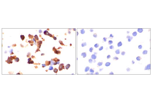  Image 52: Small Cell Lung Cancer Biomarker Antibody Sampler Kit