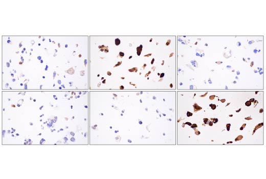 Image 59: Small Cell Lung Cancer Biomarker Antibody Sampler Kit
