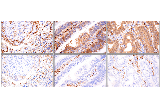  Image 61: Small Cell Lung Cancer Biomarker Antibody Sampler Kit