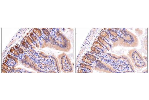  Image 28: Hippo Pathway: Upstream Signaling Antibody Sampler Kit