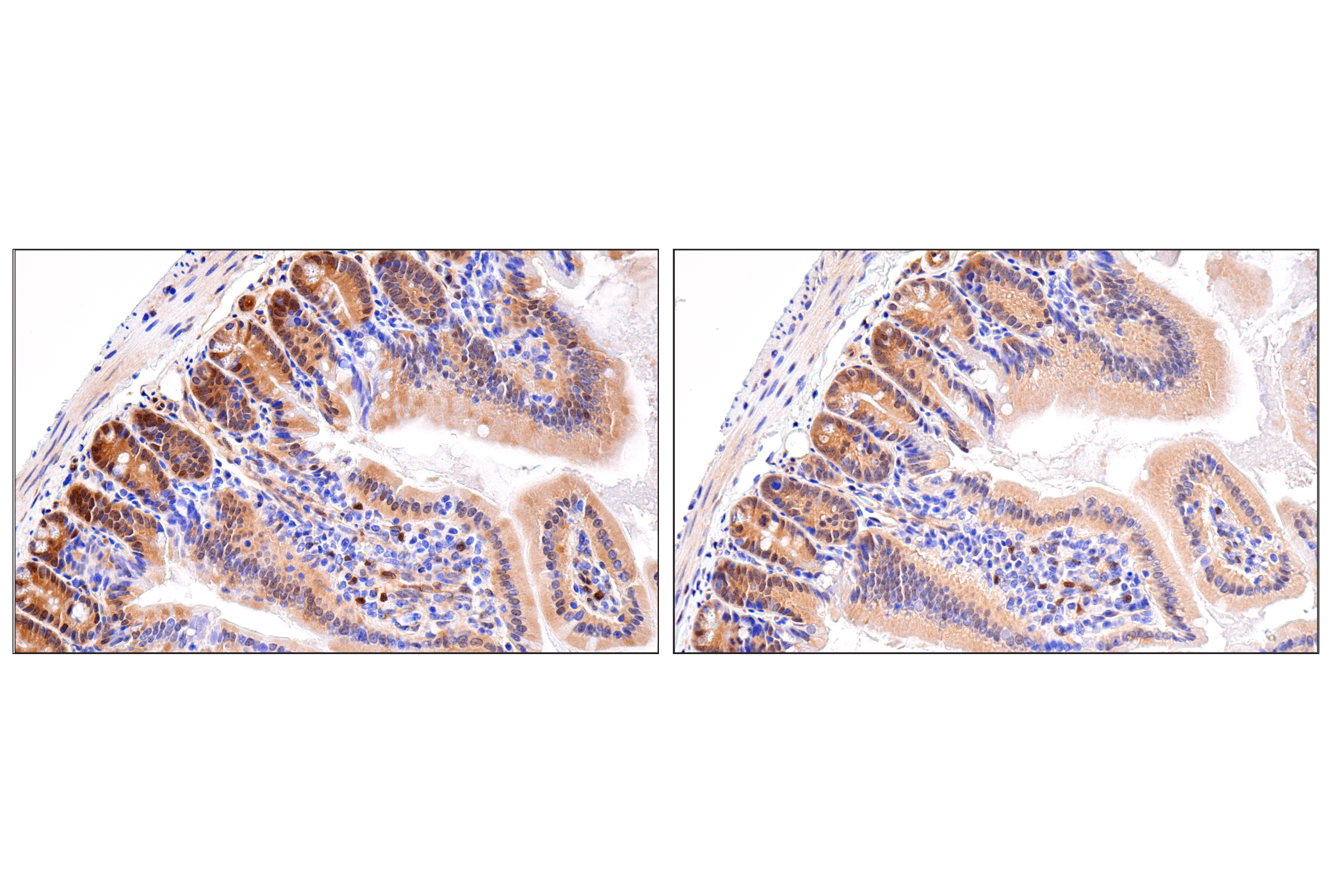  Image 70: Small Cell Lung Cancer Biomarker Antibody Sampler Kit