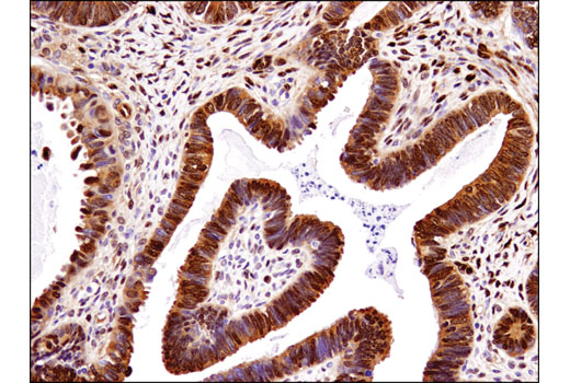 Image 29: Hippo Pathway: Upstream Signaling Antibody Sampler Kit