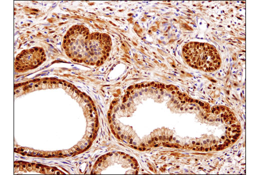 Image 71: Small Cell Lung Cancer Biomarker Antibody Sampler Kit