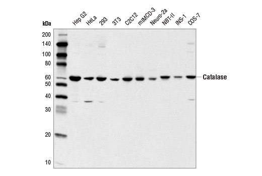 Western Blotting Image 1: Catalase (D5N7V) Rabbit mAb