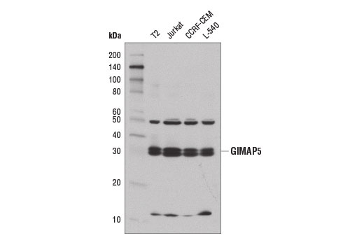 Western Blotting Image 1: GIMAP5 Antibody