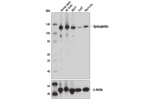  Image 3: Neuronal Scaffold Proteins Antibody Sampler Kit