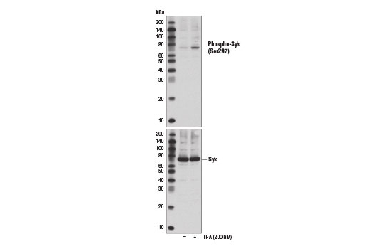 Western Blotting Image 1: Phospho-Syk (Ser297) Antibody