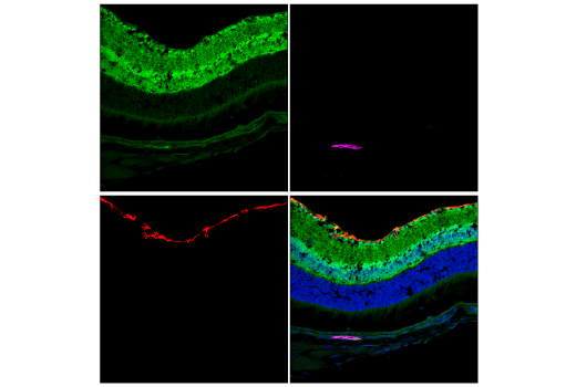 Immunofluorescence Image 1: CDK5 (D1F7M) Rabbit mAb