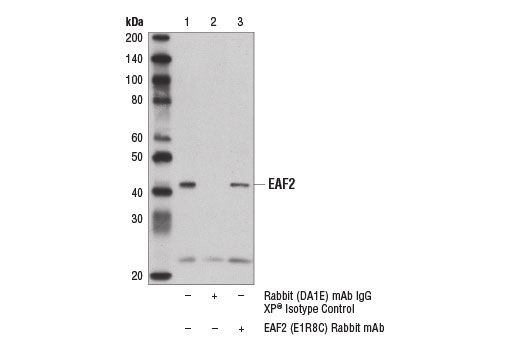 Immunoprecipitation Image 1: EAF2 (E1R8C) Rabbit mAb