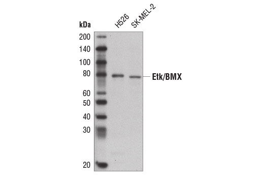 Western Blotting Image 1: Etk/BMX Antibody