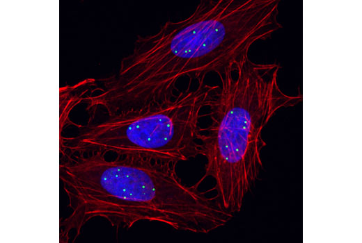 Immunofluorescence Image 1: Coilin (D2L3J) XP® Rabbit mAb