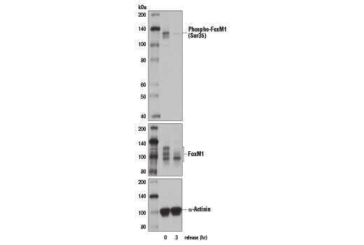 Western Blotting Image 1: Phospho-FoxM1 (Ser35) Antibody