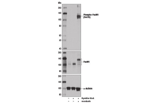 Western Blotting Image 2: Phospho-FoxM1 (Ser35) Antibody