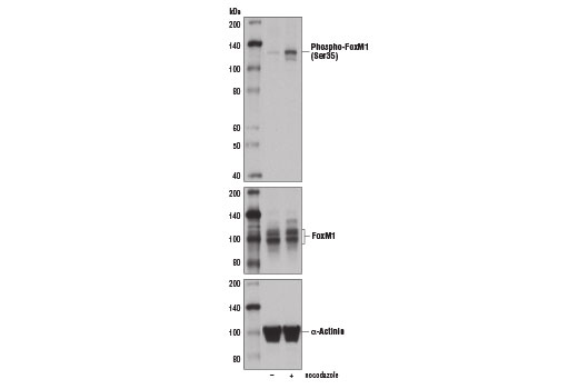 Western Blotting Image 3: Phospho-FoxM1 (Ser35) Antibody