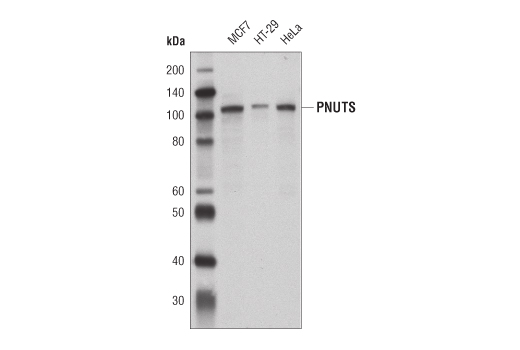 Western Blotting Image 1: PNUTS Antibody