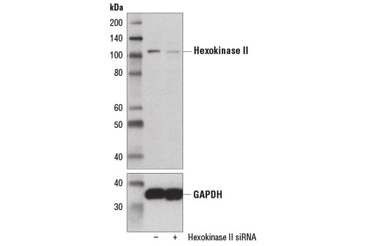  Image 1: SignalSilence® Hexokinase II siRNA I