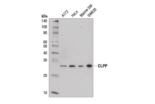 Western Blotting Image 1: CLPP Antibody