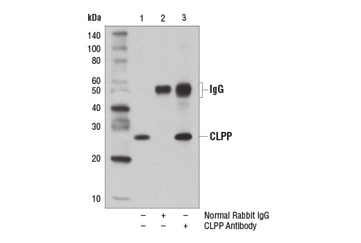 Immunoprecipitation Image 1: CLPP Antibody