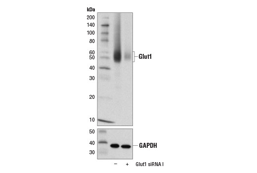  Image 1: SignalSilence® Glut1 siRNA I